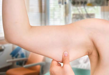 woman pinches saggy arm