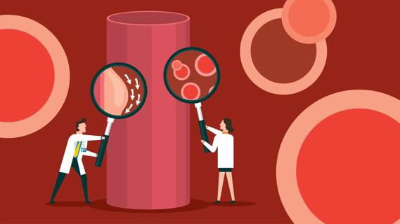 Two doctors holding up oversized magnifying glasses to giant blood vessel