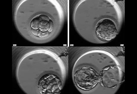 Time-Lapse Images of Embryo Cell Division Are Giving IVF Researchers New Clues