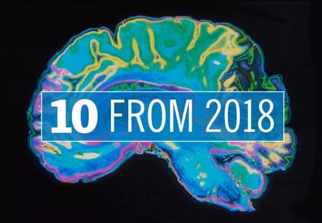19-NEU-020-Neuro-2018
