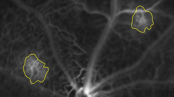 Yellow outlines on two areas of white lines on a black background