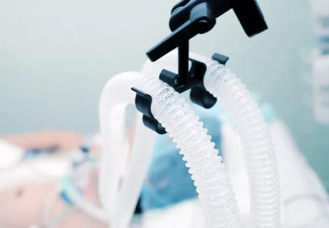 Case Study in Collaboration: Decreasing Prolonged Post-CABG Ventilation Rates