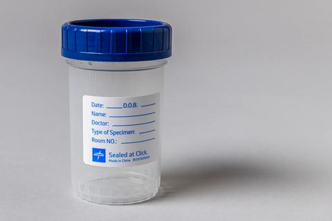Specimen cup