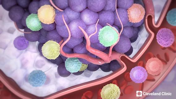Neoadjuvant therapy