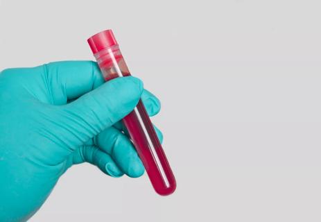 Green gloved hand holding a blood sample. Panoramic image with copy space.