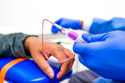 Genediting Therapy Shows Success Against Severe Sickle Cell Disease