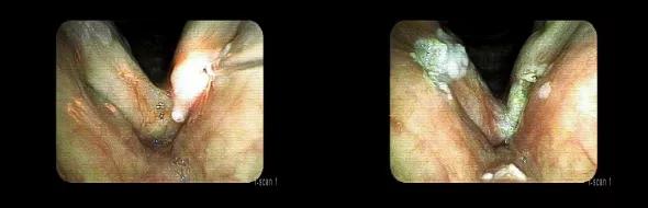 14-ENT-2017-Bryson-Inset-Image-03-590pxl-width