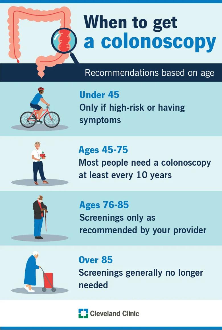 Recommended ages to get colonoscopies