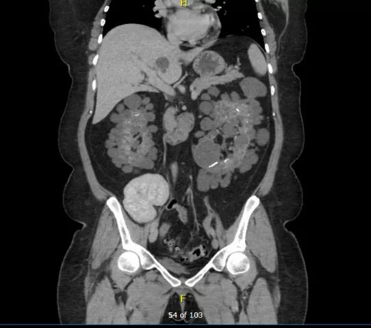 Urbina 2_Figure 2