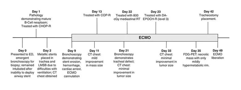 ECMO Provides Lifesaving Support to a Patient With Mediastinal Mass and Respiratory Failure 