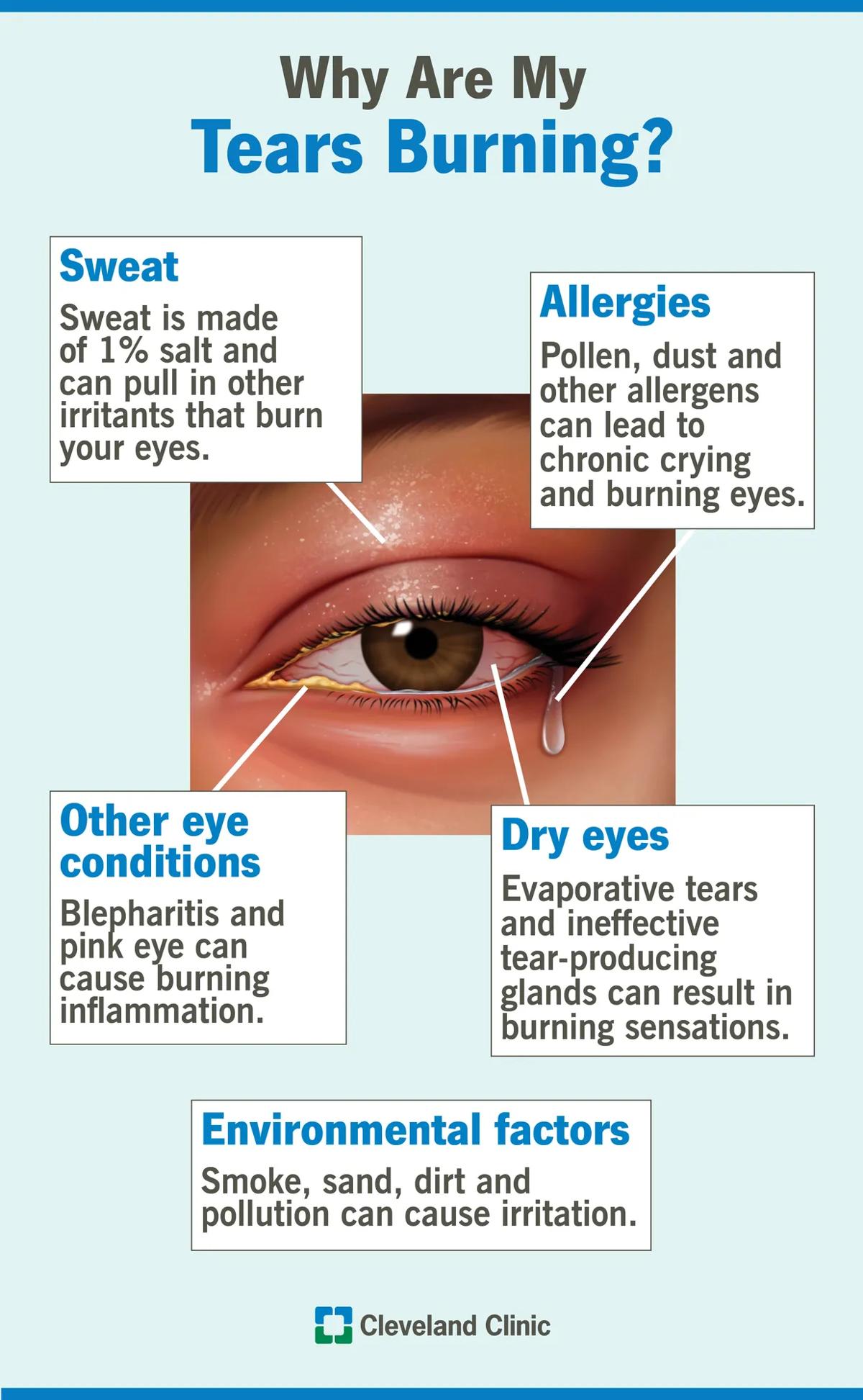 Common causes of burning tears