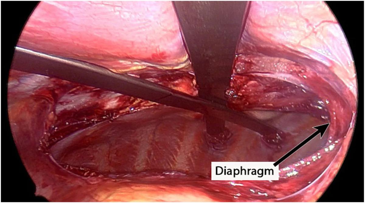 Photo showing bars inside chest