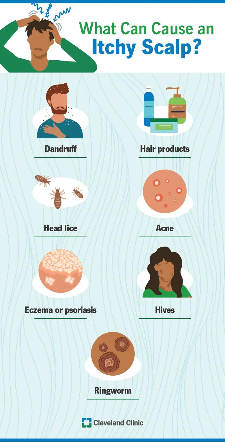 Causes of itchy scalp, including dandruff, ringworm and head lice