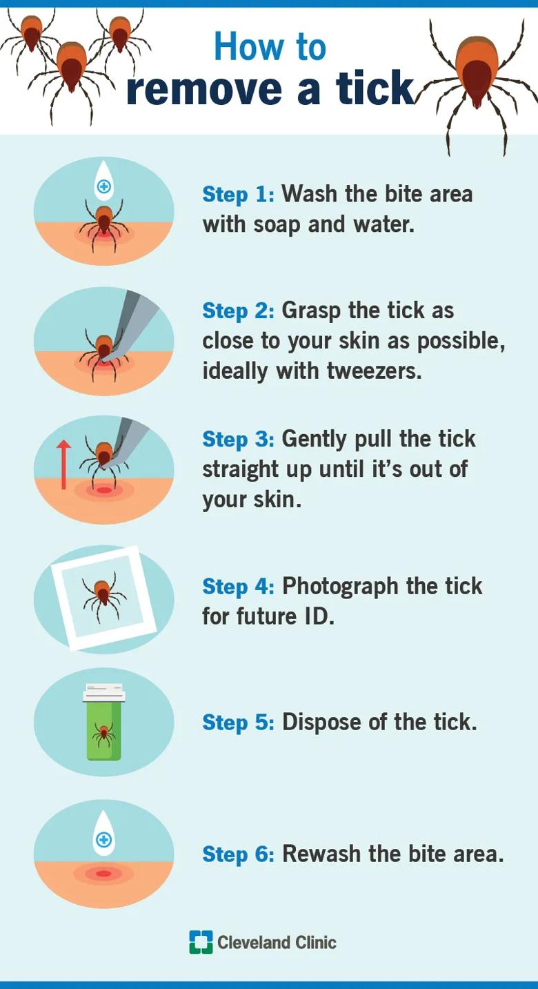 How to remove a tick