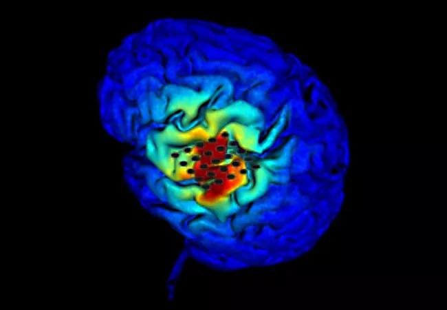 Brain Stimulation Research for Spinal Cord Injury Rehab Draws $2.5