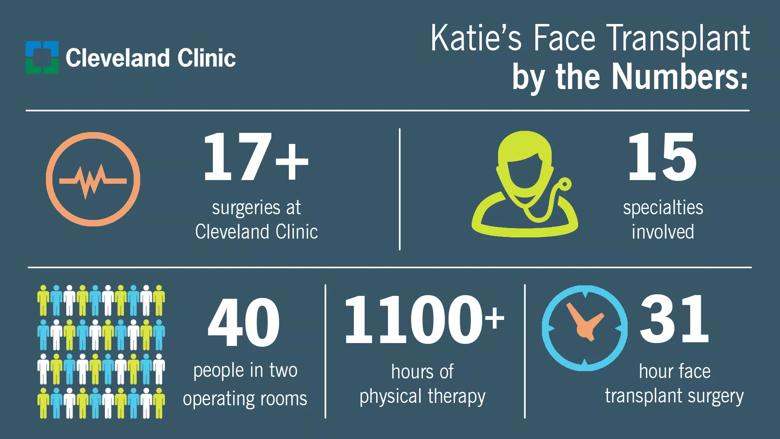 Katie Stubblefield face transplant Cleveland Clinic