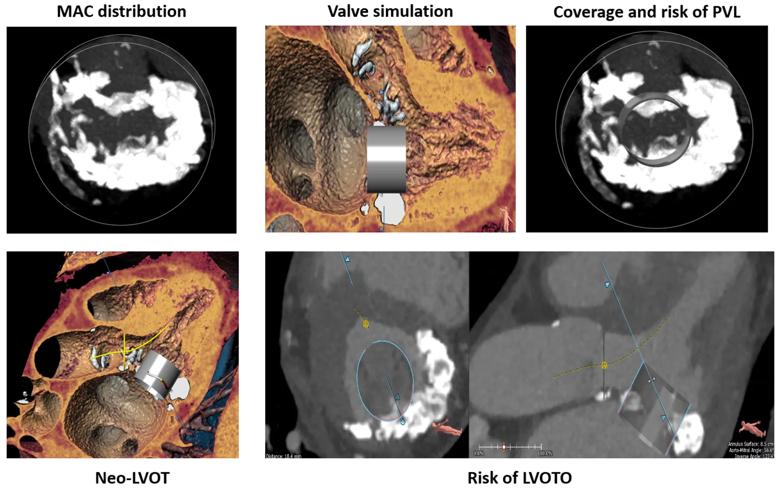 six imaging studies of the heart arranged in panels
