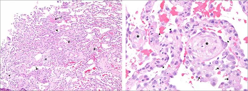 Figure 2A and 2B