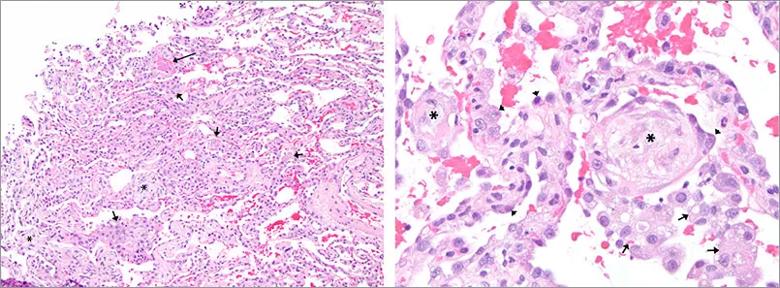 Figure 2A and 2B