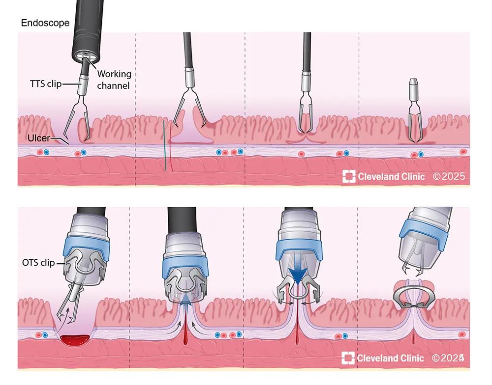 Abdominal surgical emergencies illustration