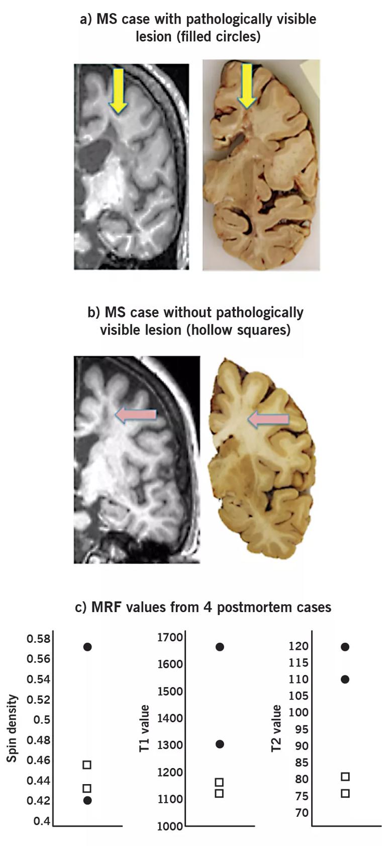 16-neu-1937-ontaneda-fig3rev-3