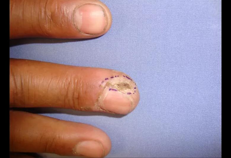 A close-up of fingernails