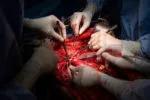 Preparing for implantation and anastomosis of the donor organs.