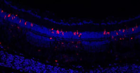 Yuan zebrafish retina study