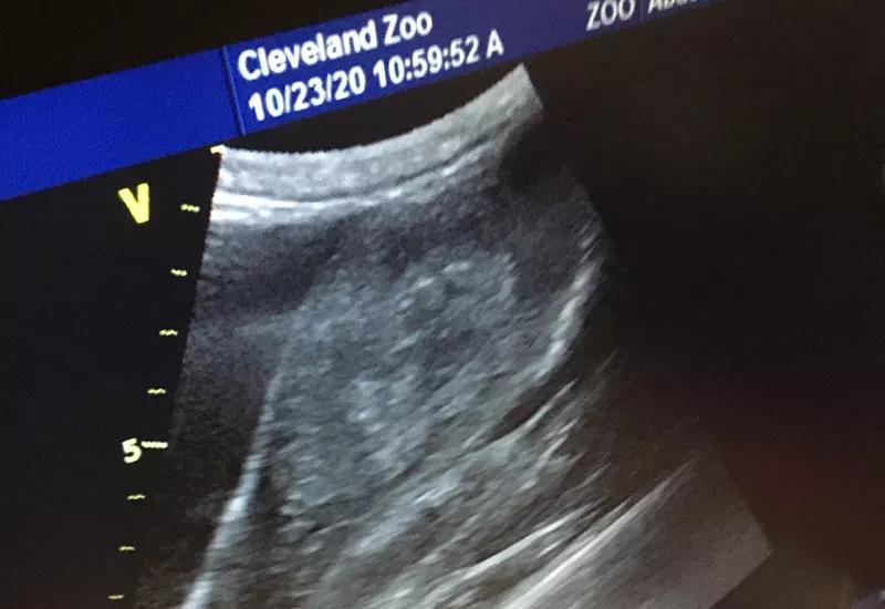 Ultrasound