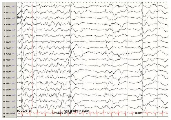 Parikh-fig2