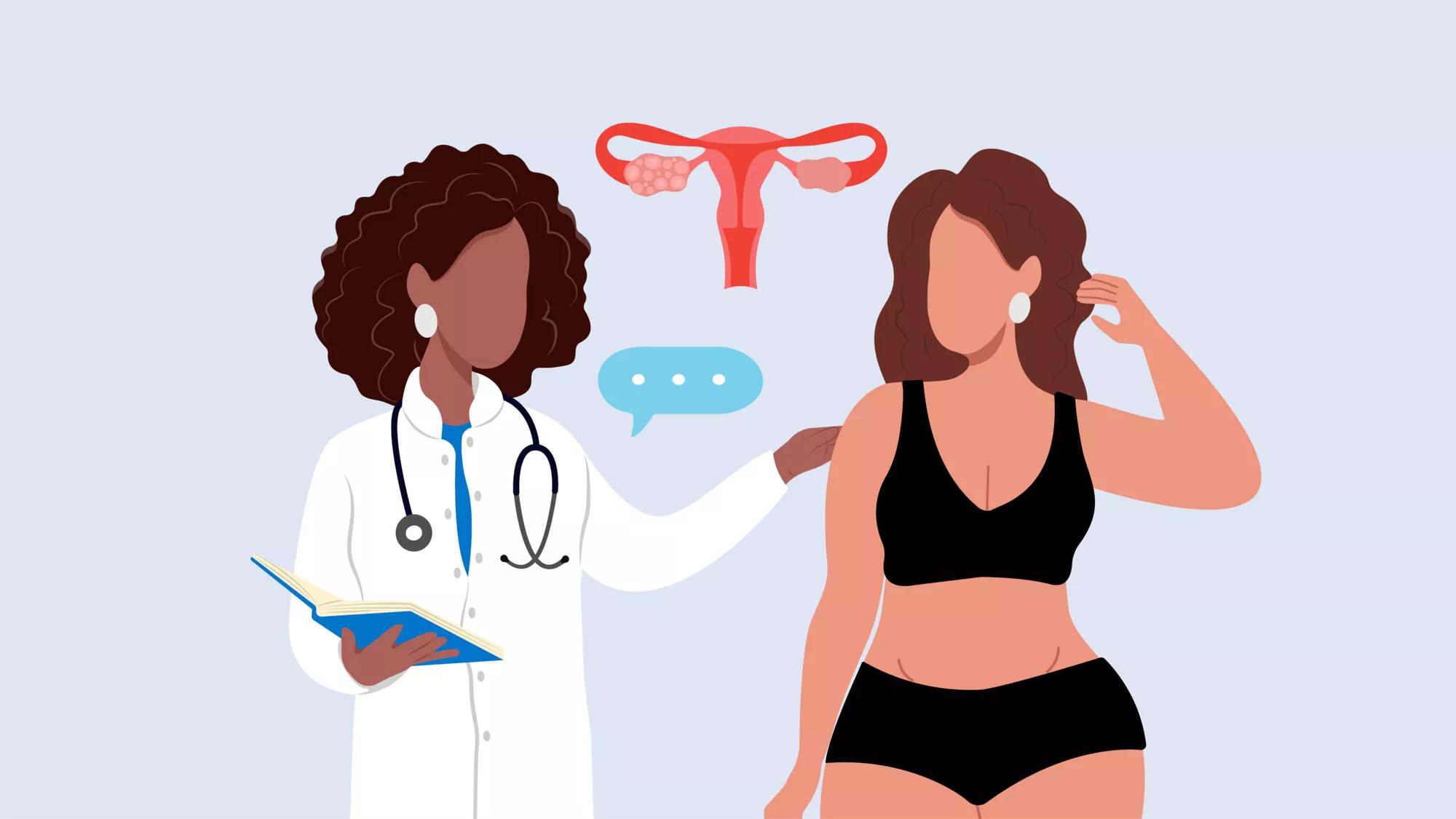 PCOS Belly: Causes and Treatment