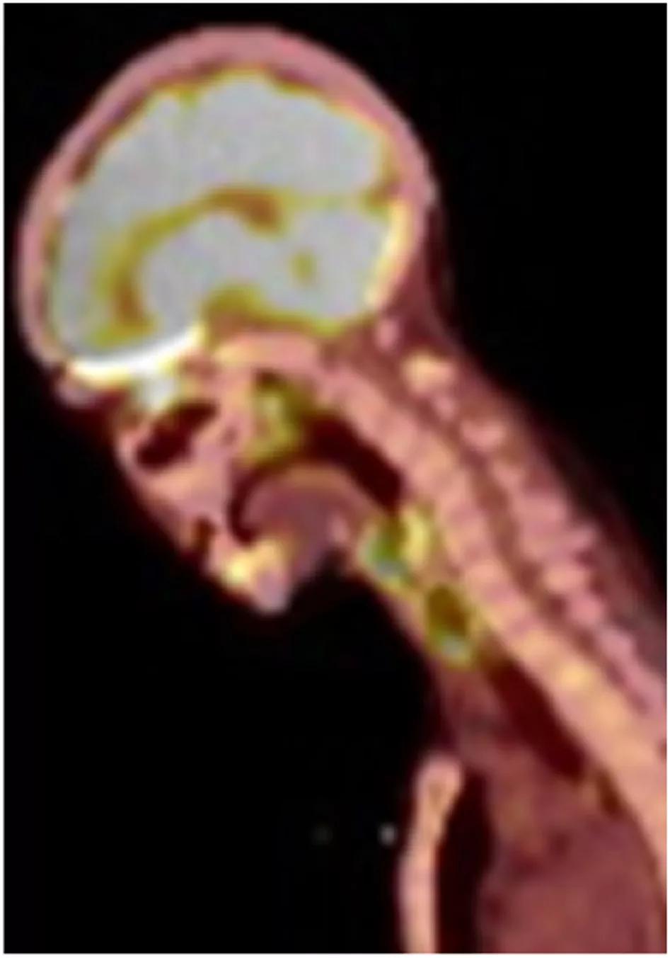Fig. 2