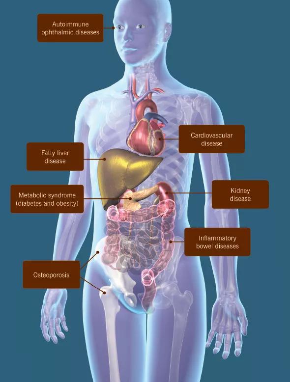 Figure. An overview of comorbidities most commonly seen with psoriatic arthritis. 