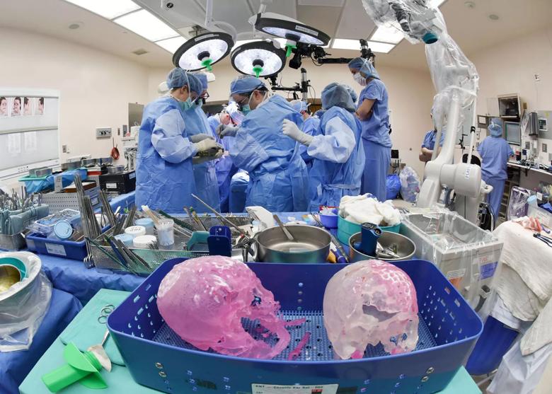 Katie Stubblefield face transplant Cleveland Clinic