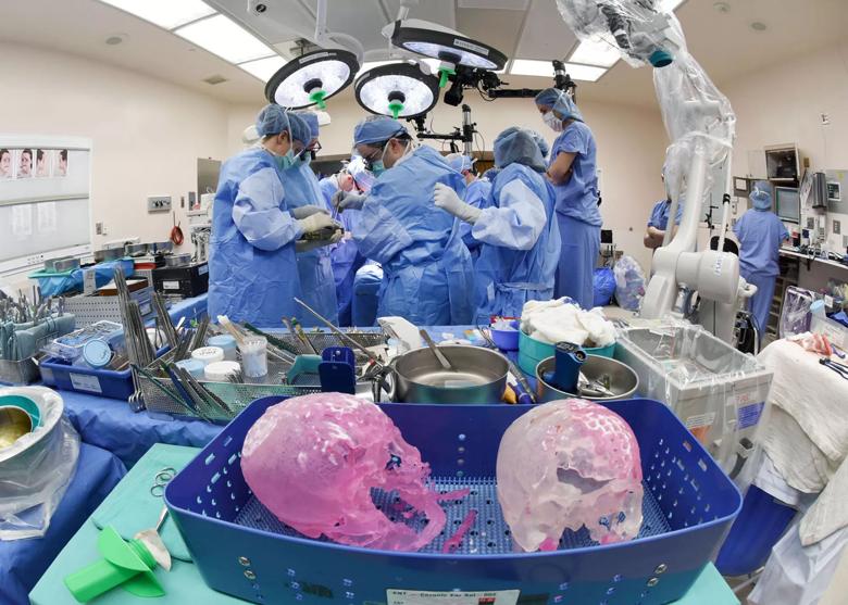 Face transplant Cleveland Clinic