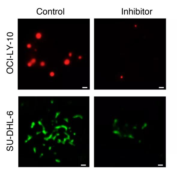 Immunochemistry images of DLBCL cells treated using antibodies. 