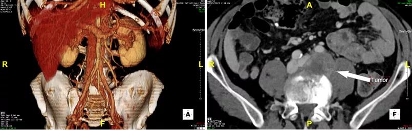 two side-by-side scans of organs of a person's midsection