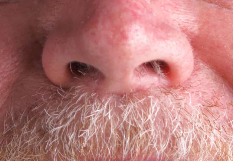 Nose Hair Why We Have Them and How to Get Rid of Them