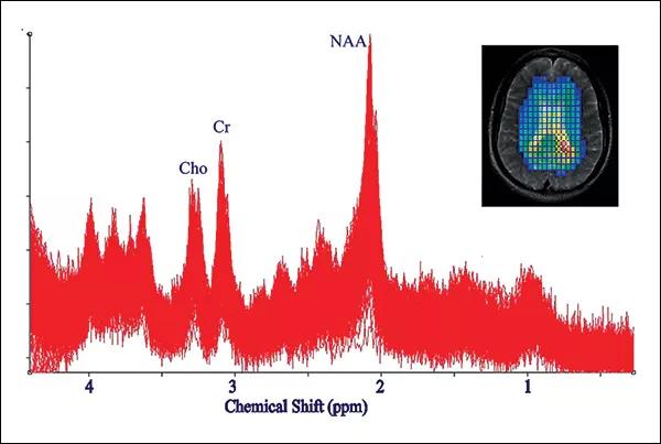 600x in story Whole Brain fig1