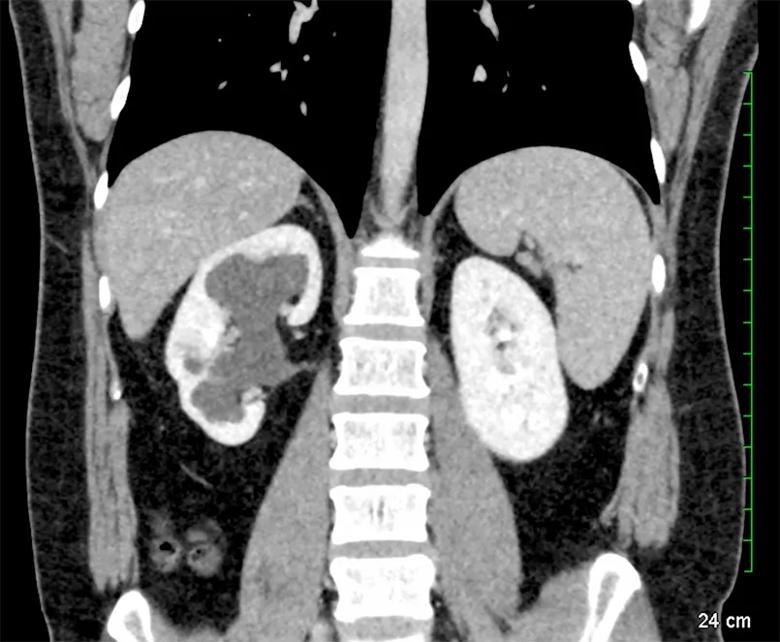 inset-krishnan-figure-1