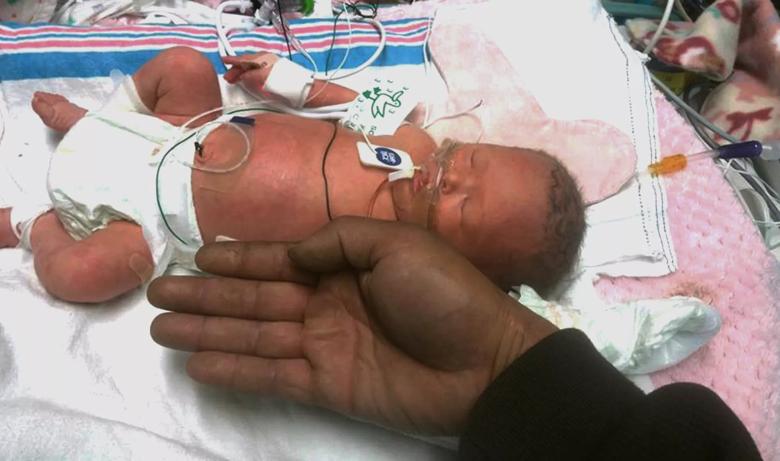 Cleveland Clinic Children's NICU leukemia