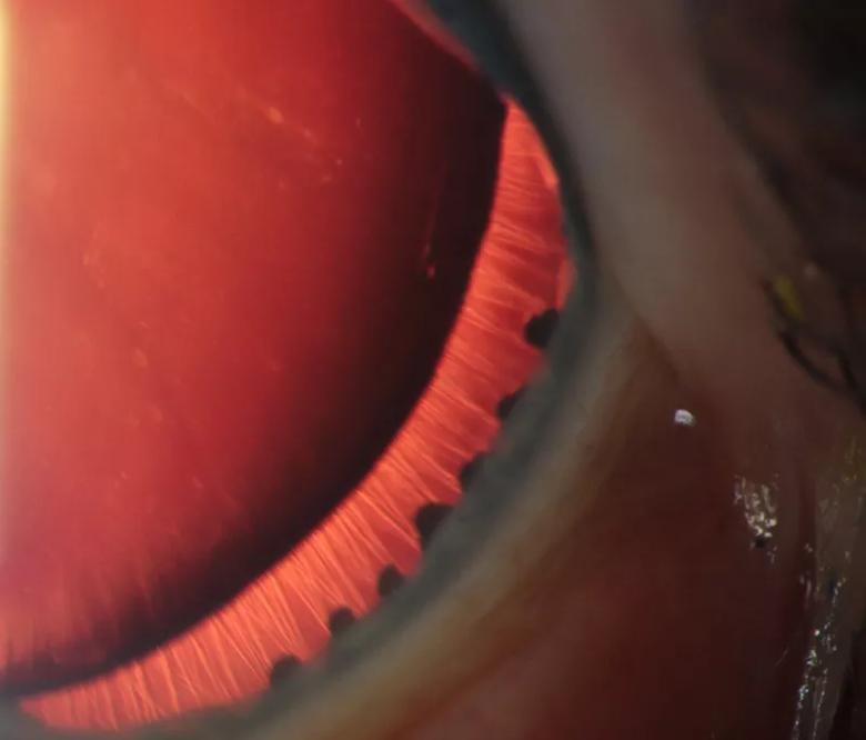 Red ruffled edge inside the eye