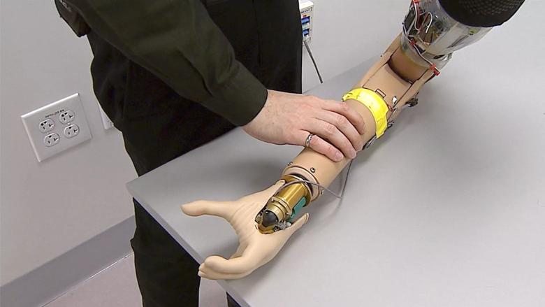 Cleveland Clinic researcher with prosthetic arm