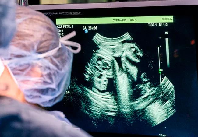 Advance Planning for Congenital Heart Defects Improves Outcomes