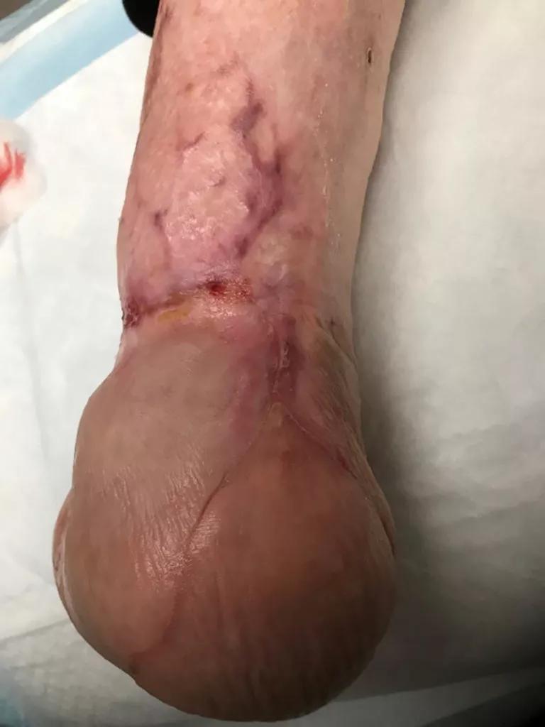 Ankle