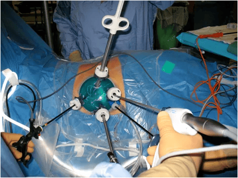 15-URL-063-Nephrectomy-fig1