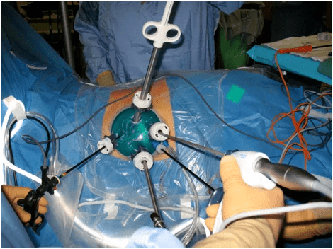 15-URL-063-Nephrectomy-fig1