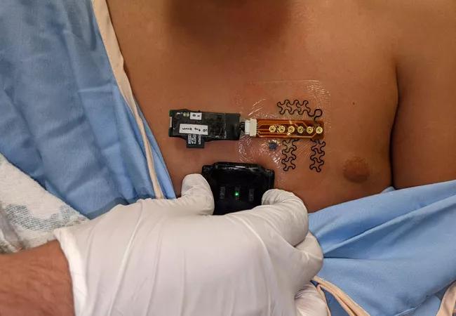 Biosensor