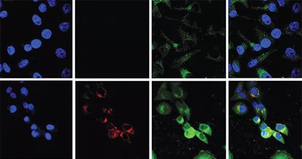 Figure 1. Propagation of vertically transmitted RSV in the rat. Magnified at 60×, extracts of whole fetuses are shown that were delivered from dams inoculated with recombinant RSV (rrRSV; bottom row) or from pathogenfree controls (top row) and co-cultured with human airway epithelial cells. The micrographs show red fluorescence in the cytoplasm of cells exposed to fetal extracts from rrRSV-infected dams, confirming the presence of actively replicating infectious virus associated with markedly increased green nerve growth factor (NGF) immunoreactivity. Reprinted from Piedimonte et al, PLOS ONE.1