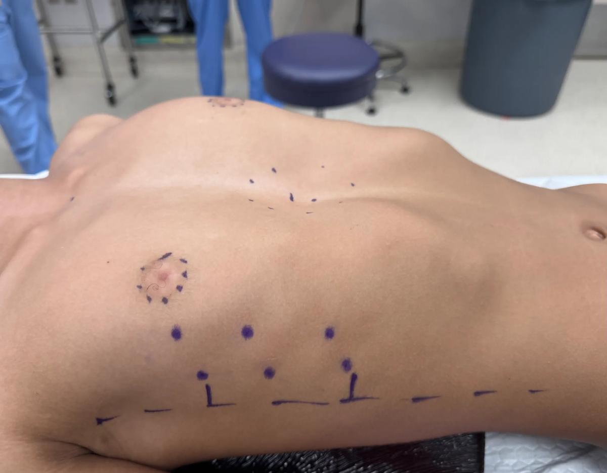 Photo of patient's chest